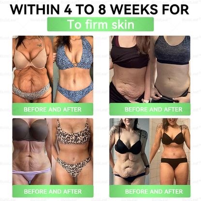 👩‍⚕️🇺🇲👩‍⚕️ 80Off% 𝑩𝒖𝒊𝒍𝒅𝑳𝒆𝒂𝒇®𝐒𝐌𝐆𝐓-𝐆𝐋𝐏-𝟏 8-𝐢𝐧-𝟏 𝐏𝐥𝐚𝐧𝐭-𝐏𝐨𝐰𝐞𝐫𝐞𝐝 𝐖𝐞𝐥𝐥𝐧𝐞𝐬𝐬 𝐄𝐥𝐢𝐱𝐢𝐫 | Once a day — see visible results in just 7 days! Supports weight, heart, blood sugar, gut, joints & energy.