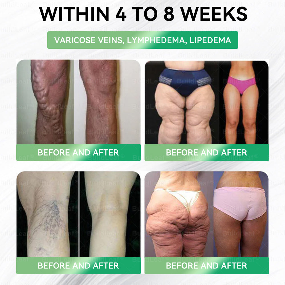 👩‍⚕️🇺🇲👩‍⚕️ 80Off% 𝑩𝒖𝒊𝒍𝒅𝑳𝒆𝒂𝒇®𝐒𝐌𝐆𝐓-𝐆𝐋𝐏-𝟏 8-𝐢𝐧-𝟏 𝐏𝐥𝐚𝐧𝐭-𝐏𝐨𝐰𝐞𝐫𝐞𝐝 𝐖𝐞𝐥𝐥𝐧𝐞𝐬𝐬 𝐄𝐥𝐢𝐱𝐢𝐫 | Once a day — see visible results in just 7 days! Supports weight, heart, blood sugar, gut, joints & energy.