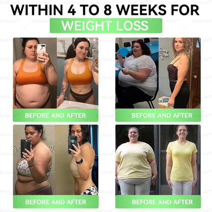 🇺🇲🇺🇲🇺🇲80off%|𝑩𝒖𝒊𝒍𝒅𝑳𝒆𝒂𝒇®𝐒𝐌𝐆𝐓-𝐆𝐋𝐏-𝟏 8-𝐢𝐧-𝟏 𝐏𝐥𝐚𝐧𝐭-𝐏𝐨𝐰𝐞𝐫𝐞𝐝 𝐖𝐞𝐥𝐥𝐧𝐞𝐬𝐬 𝐄𝐥𝐢𝐱𝐢𝐫 | 𝐆𝐞𝐧𝐭𝐥𝐞 𝐃𝐚𝐢𝐥𝐲 𝐒𝐮𝐩𝐩𝐨𝐫𝐭 𝐟𝐨𝐫 𝐁𝐨𝐝𝐲 𝐁𝐚𝐥𝐚𝐧𝐜𝐞, 𝐄𝐧𝐞𝐫𝐠𝐲 & 𝐌𝐞𝐭𝐚𝐛𝐨𝐥𝐢𝐜 𝐇𝐚𝐫𝐦𝐨𝐧𝐲