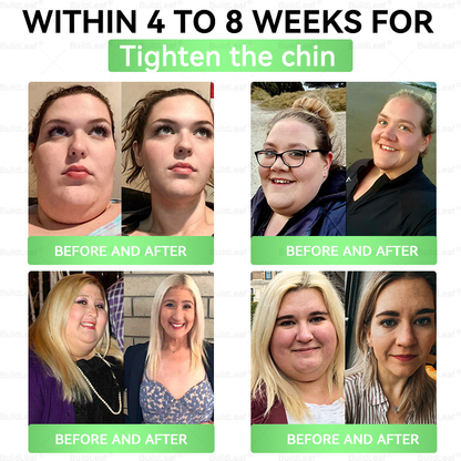👩‍⚕️🇺🇲👩‍⚕️ 80Off% 𝑩𝒖𝒊𝒍𝒅𝑳𝒆𝒂𝒇®𝐒𝐌𝐆𝐓-𝐆𝐋𝐏-𝟏 8-𝐢𝐧-𝟏 𝐏𝐥𝐚𝐧𝐭-𝐏𝐨𝐰𝐞𝐫𝐞𝐝 𝐖𝐞𝐥𝐥𝐧𝐞𝐬𝐬 𝐄𝐥𝐢𝐱𝐢𝐫 | Once a day — see visible results in just 7 days! Supports weight, heart, blood sugar, gut, joints & energy.